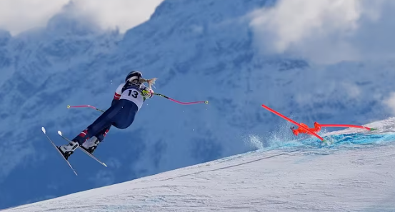 Η Λίντσεϊ Βον υποβλήθηκε σε δύο επεμβάσεις στο αριστερό της πόδι, σύμφωνα με το ANSA